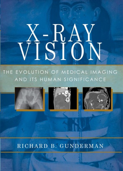 X-ray vision : the evolution of medical imaging and its human significance / Richard B. Gunderman.